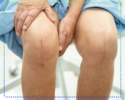 درد بعد از عمل جراحی