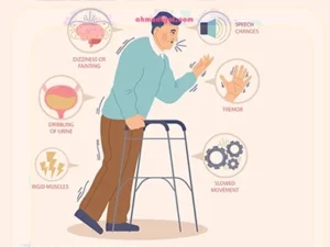 بیماری پارکینسون