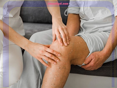 مزیت فیزیوتراپی ACL